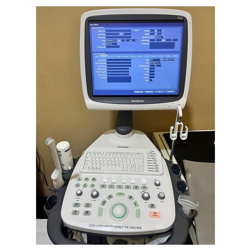 Portable Ultrasound System Versana