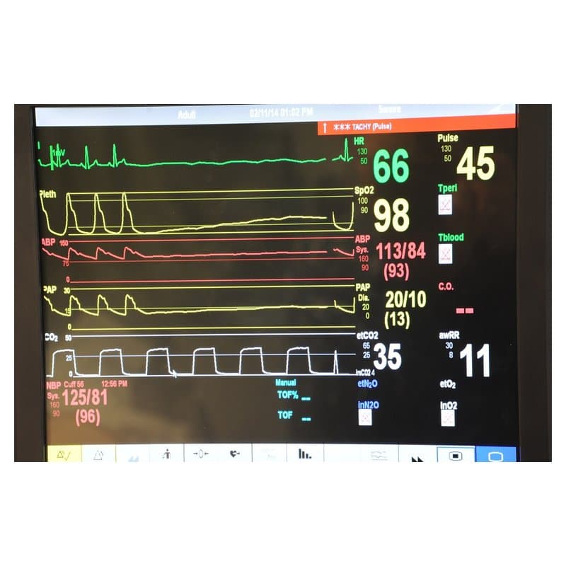 Vital Signs Monitor VS-900